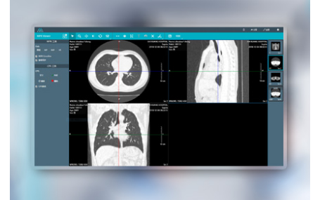 影像质控/报告质控/激光胶片迈德卫影像云-云胶片的技术优势有哪些？