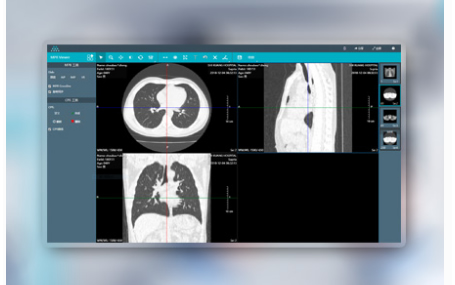 云胶片/电子胶片迈德卫影像云-热敏胶片：医疗影像的幕后英雄