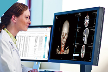 远程超声/影像云迈德卫医疗-一张胶片，关乎诊断精度：激光胶片与热敏胶片的 “影像对决”