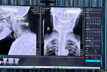 云胶片/医共体软件迈德卫影像云-一张“云片子”，跨越山河的生命守护——远程影像诊断正在改变基层就医格局