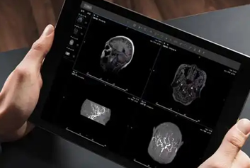 云胶片/医疗影像云迈德卫医疗-跨越千里的生命牵手：远程医疗让爱不再遥远