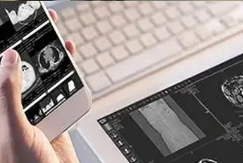 云胶片/医疗自助机迈德卫影像云-电子胶片能存多久？答案可能超出你的预期