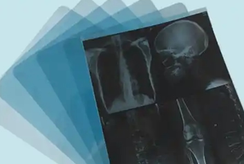 热敏胶片/医疗自助机迈德卫影像云-一张激光胶片，藏着守护健康的万千细节